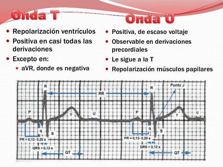 interpretacion de electrocardiograma